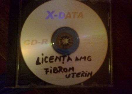 Licenta Ingrijirea Pacientei cu FIBROM UTERIN